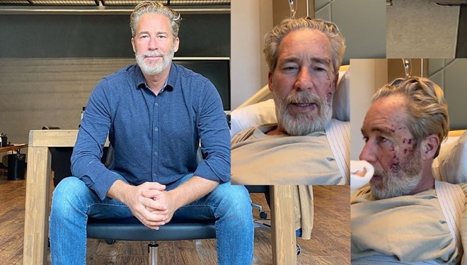 Ünlü oyuncu Sinan Albayrak dizi setinde korkunç bir kaza geçirmişti! "İsrail" detayı şok etti! Böyle açıkladı