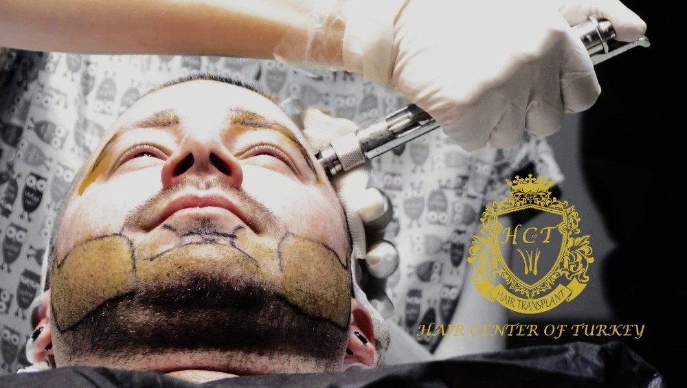 Ünlülerin tercihi Hair Center Of Turkey 