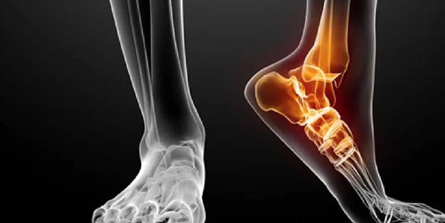 Uygunsuz egzersiz ayak ağrılarına neden oluyor