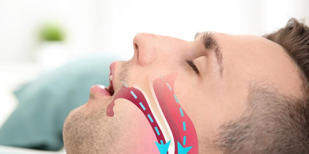 Uyumadan önce için horlamayı bitiriyor: Hemen bunu yapın, gerisini düşünmeyin! İki gün içinde harika sonuç