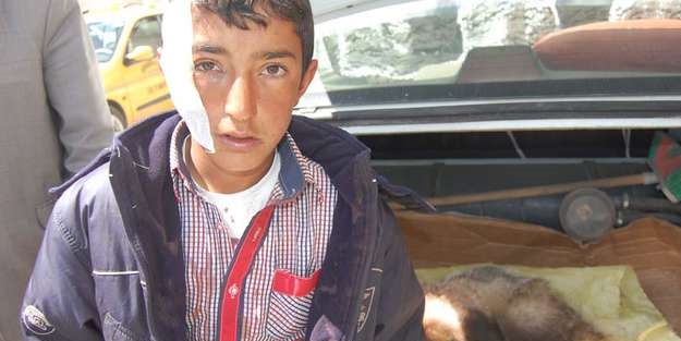 Uyurken porsuk saldırısına uğradı