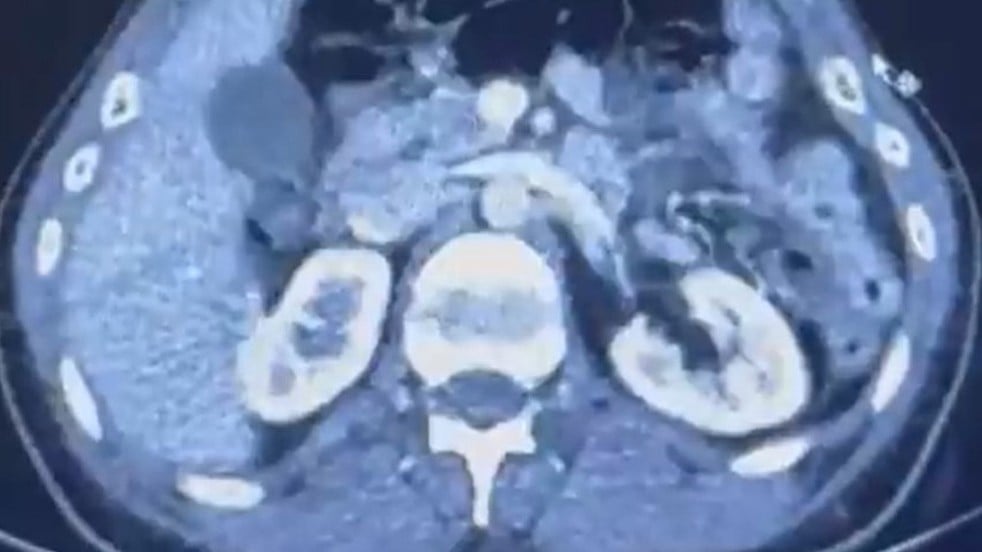 Uyuşturucuyu öyle bir yere saklamışlardı ki! İran’dan geldiler Kayseri’de yakalandılar