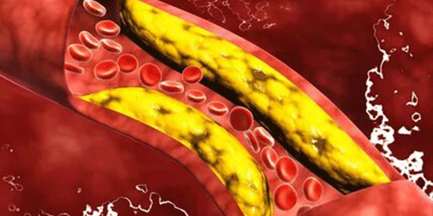 Uzm. Dyt. Selahattin Dönmez açıkladı: Kandaki yağları parçalıyor! Zayıflamak isteyenlerin mucizesi...