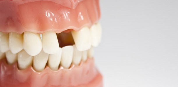 Uzman isim açıkladı! Diş kayıplarından bu yöntemle kurtulabilirsiniz