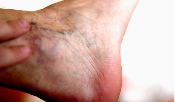 Uzman isim açıkladı! Varis en çok o mesleği yapanları etkiliyor