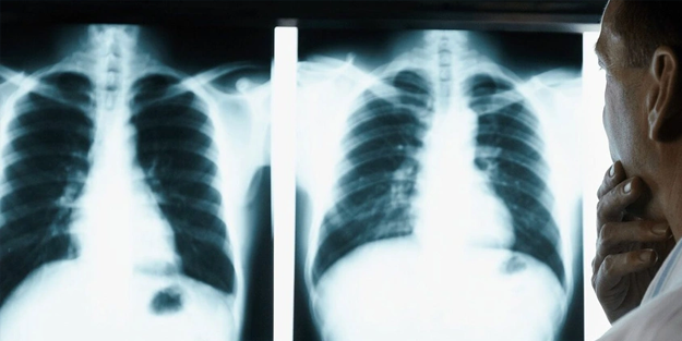 Uzman isimden acil uyarı geldi: Erkekler ve kadınlar aman dikkat!