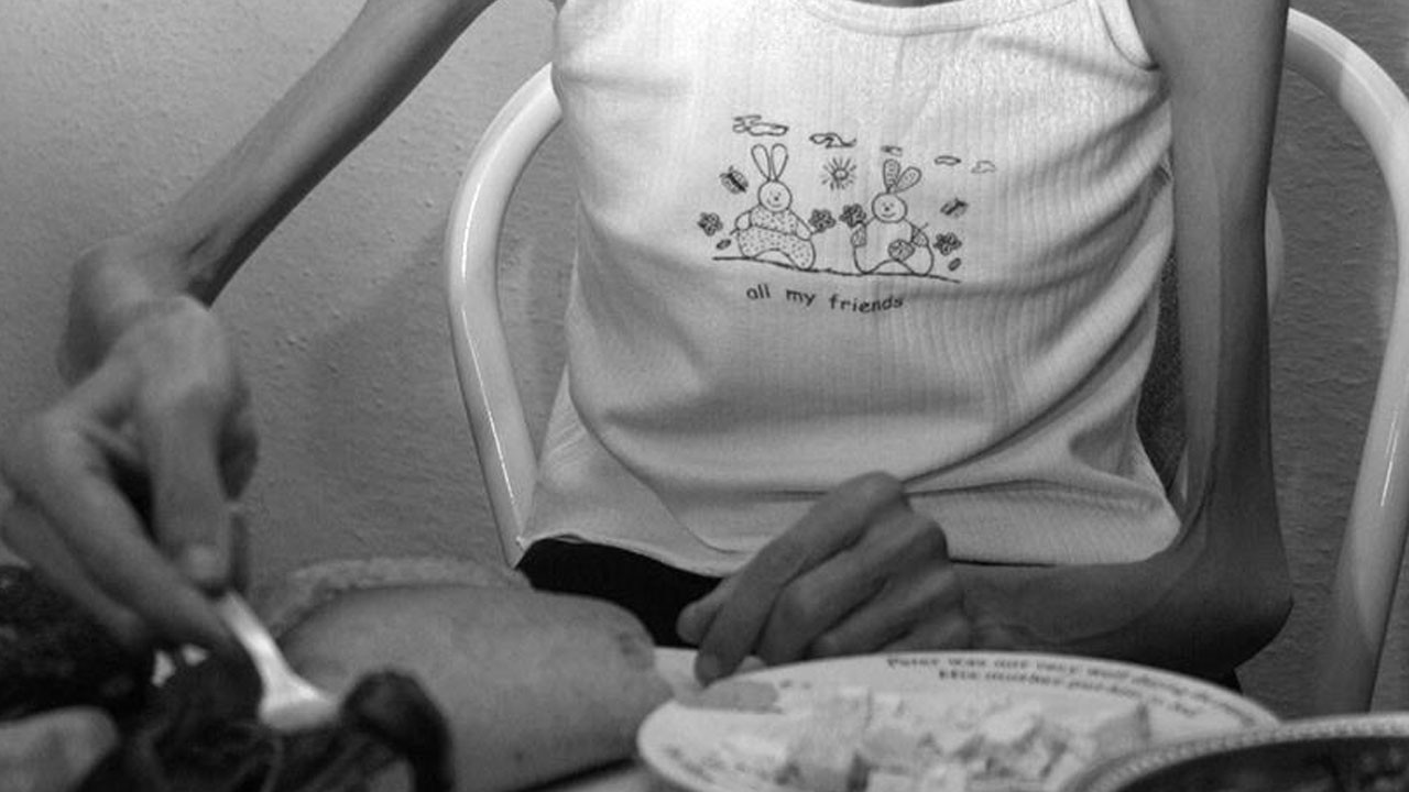 Uzman isimden ailelere kritik uyarı! Anoreksiya ölüme götürebilir