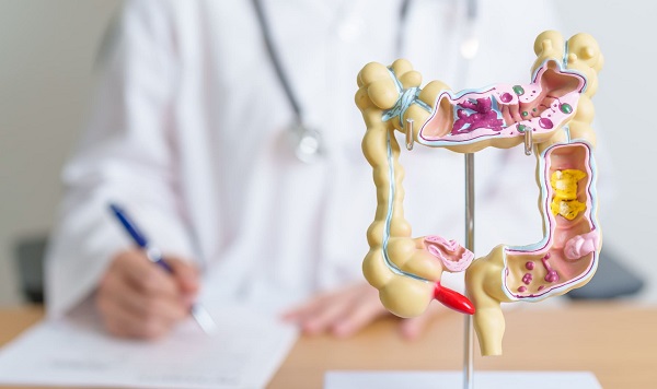 Uzman isimden altın tavsiyeler! Kolon kanserinden korunmanın 9 yolu