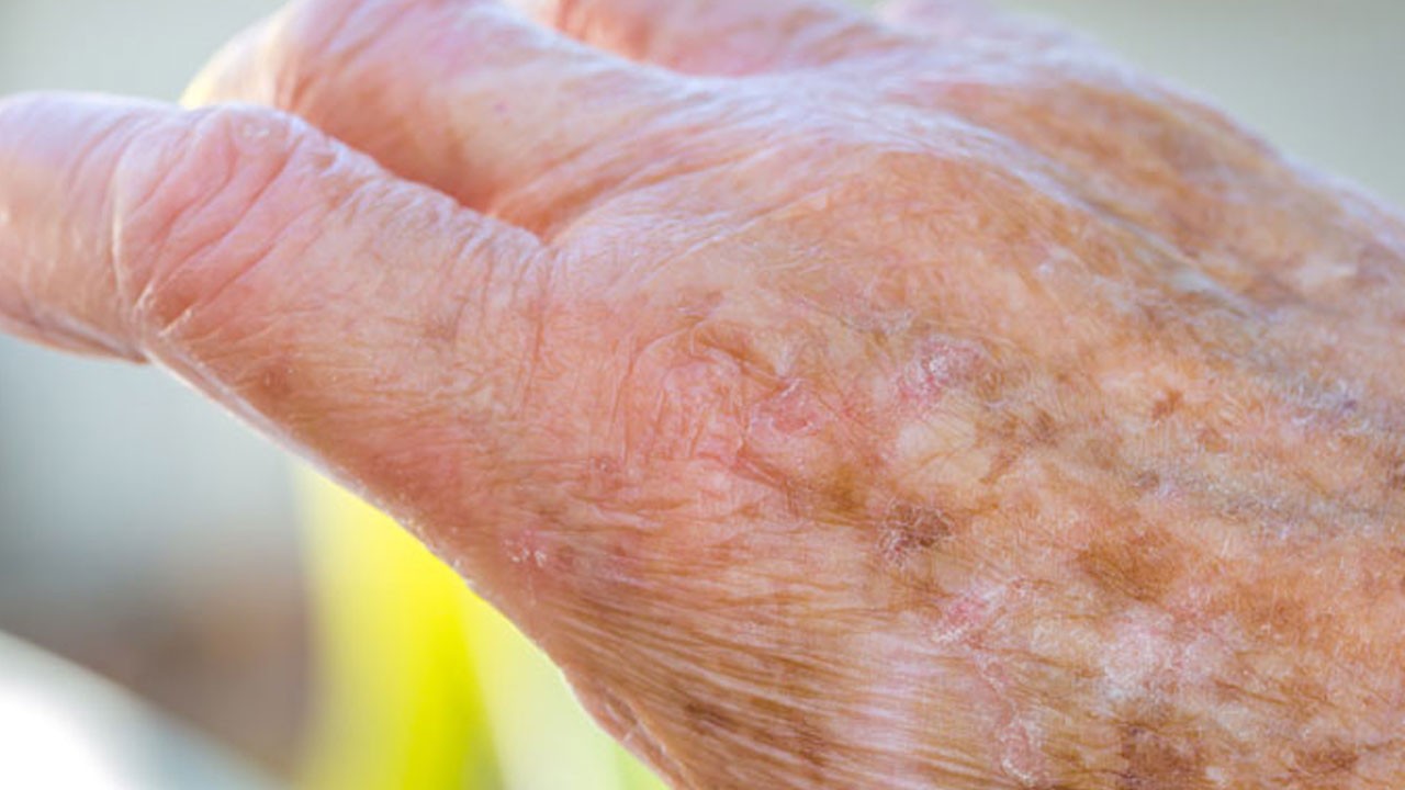 Uzman isimden önemli açıklama! Cildinizi yaşlandıran sessiz düşman