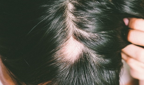 Uzman isimden sarımsak-saçkıran açıklaması | Oysa hepimiz yanlış yapıyormuşuz!