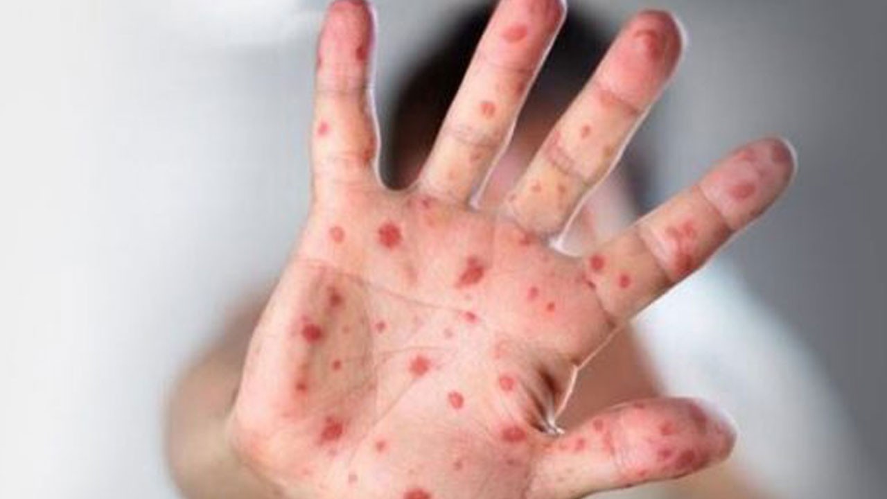 Uzmandan ailelere kritik uyarılar! 5 yaş altı çocuklar riskte