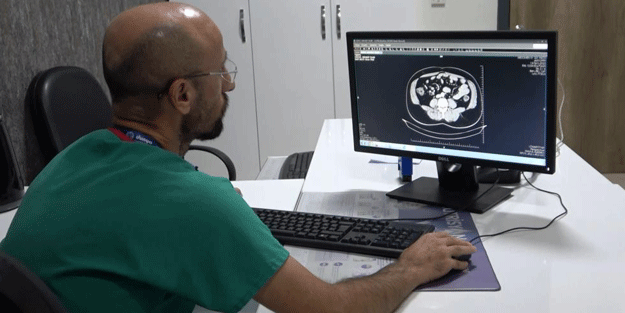 Uzmanlardan kolon kanserine karşı uyarı