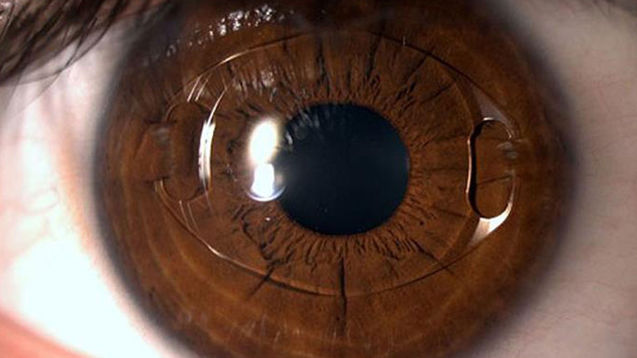 Uzmanlardan kritik uyarı! Çocuklarda adeta salgın haline geldi