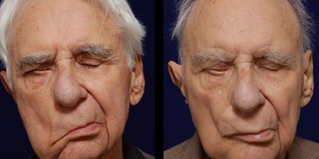 Uzmanlardan 'soğuk hava' uyarısı: Yüz felcine neden olabilir!