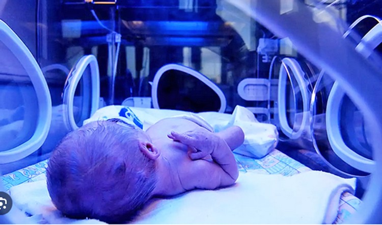 Uzmanların gözü korktu: Bu çok ciddi bir sayı: Prematüre bebek doğumunda patlama