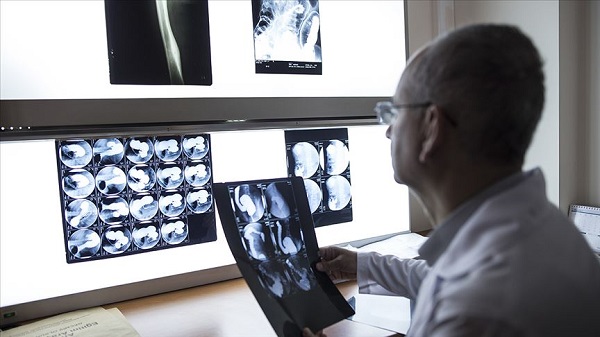 Vakalar arttı, yaşam süresi uzadı