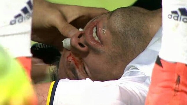 Van Persie hastaneye kaldırıldı