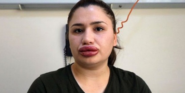 Ve bakanlık el attı!