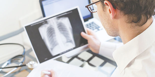 ‘Verem en çok öldüren 10 hastalıktan biri’