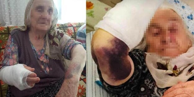 Vicdansızlık! 92 yaşındaki kayınvalidesini sopayla dövdü
