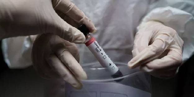 Virüs artık akıllı bir organizma gibi davranıyor