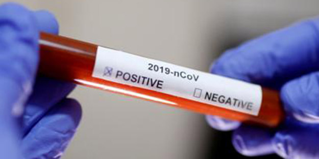 Virüs ile ilgili yeni keşif! 'Aşı ve ilaç geliştirmede yardımcı olacak'