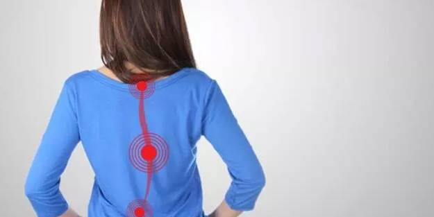 Vücuda tam oturmayan kıyafetler skolyoz belirtisi olabilir