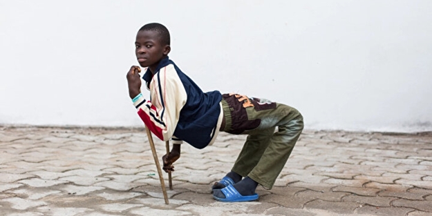 Vücudu ikiye katlanıyordu! Şimdi yürüyebiliyor