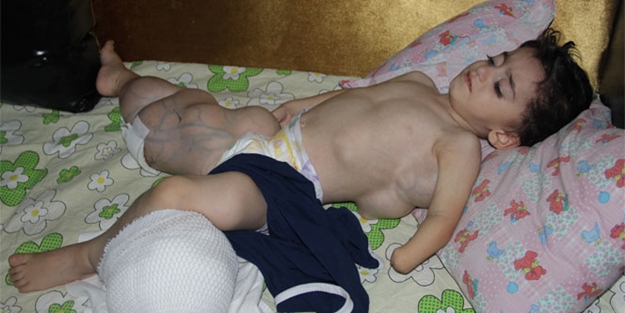 Vücudu şişen çocuğun hastalığına teşhis konulamadı
