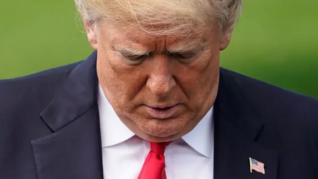 Vücudu şişmeye başlayan Trump tedaviye alındı! Beyaz Saray konulan teşhisi açıkladı