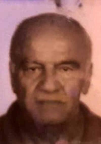 Vücuduna şişe çektirirken yandı 