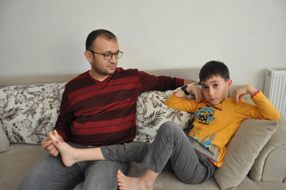 Vücudunda yanık oluşan öğrencinin babası konuştu 