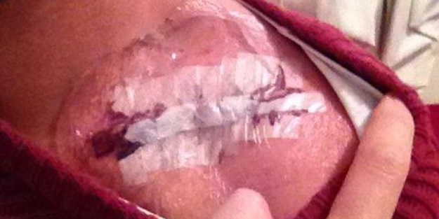 Vücudundan çıkarılan platini yüzük yaptı!