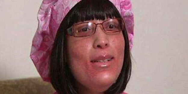 Vücudunun her yerinden tırnak çıkıyor!