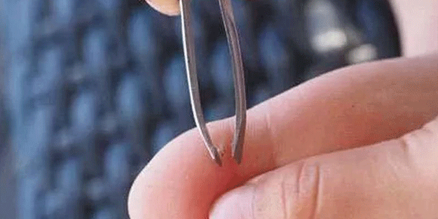 Vücudunuza giren kıymığı çıkarmanın 10 farklı yolu! İlk kez duyacaksınız