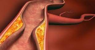 Vücuttaki iltihabı atan besinler ilaçların yerini aldı: Birden fazla derde deva! Yeni baştan düzenleyen...