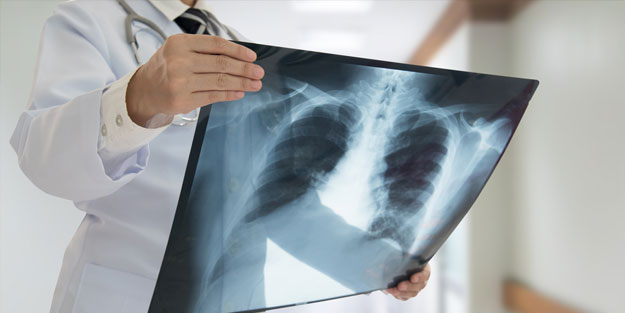 Vücuttaki iltihabı önleyen besinler