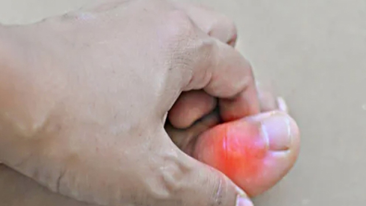 Vücuttaki ürik asidi düşürebilecek 8 besin: Prof. Dr. Canan Karatay ısrarla onu önerdi