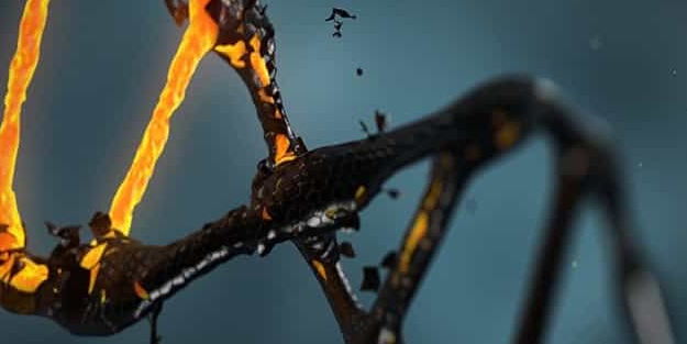 Williams sendromu nedir? Büyüme, zeka gerilemesini engelleme: Williams sendromu belirtileri ve uzak durması gereken besinler!