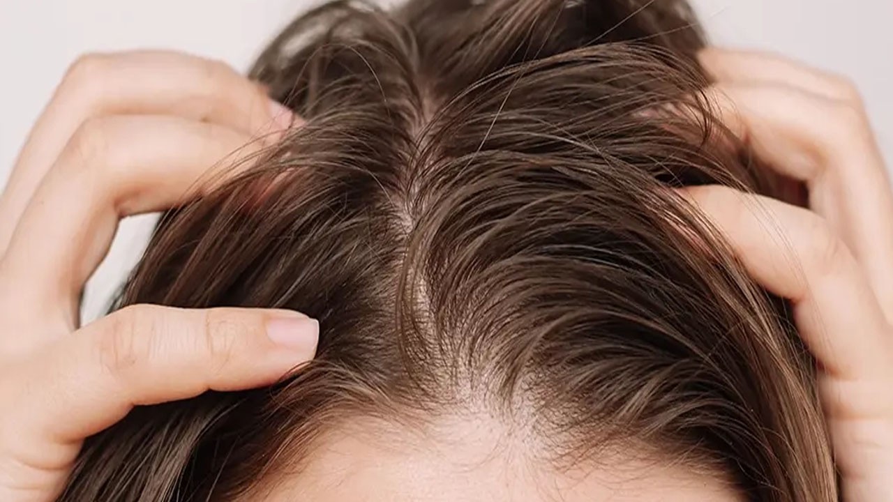 Yağlı saç derdini tarihe karıştırıyor! Saç uzatan güçlü bir karışım! Duyan aktara koştu