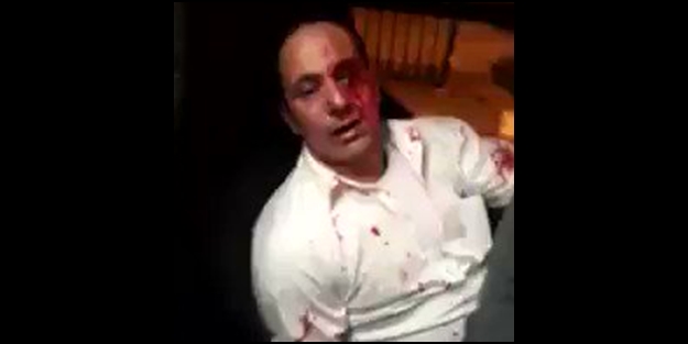 Yahudi teröristler Filistinli şoförü bu hale getirdi