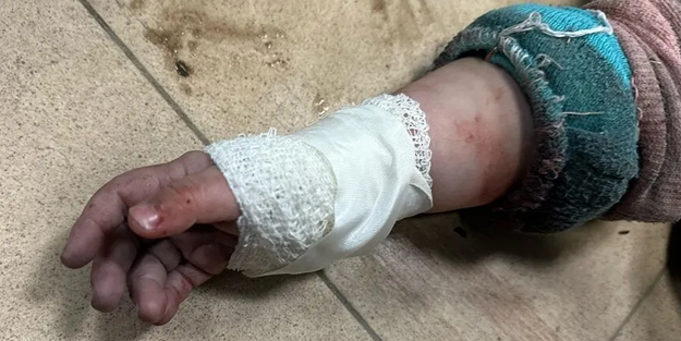 Yahudilerin yaraladığı 50 Gazzeli çocuk Kolombiya'da tedavi görecek