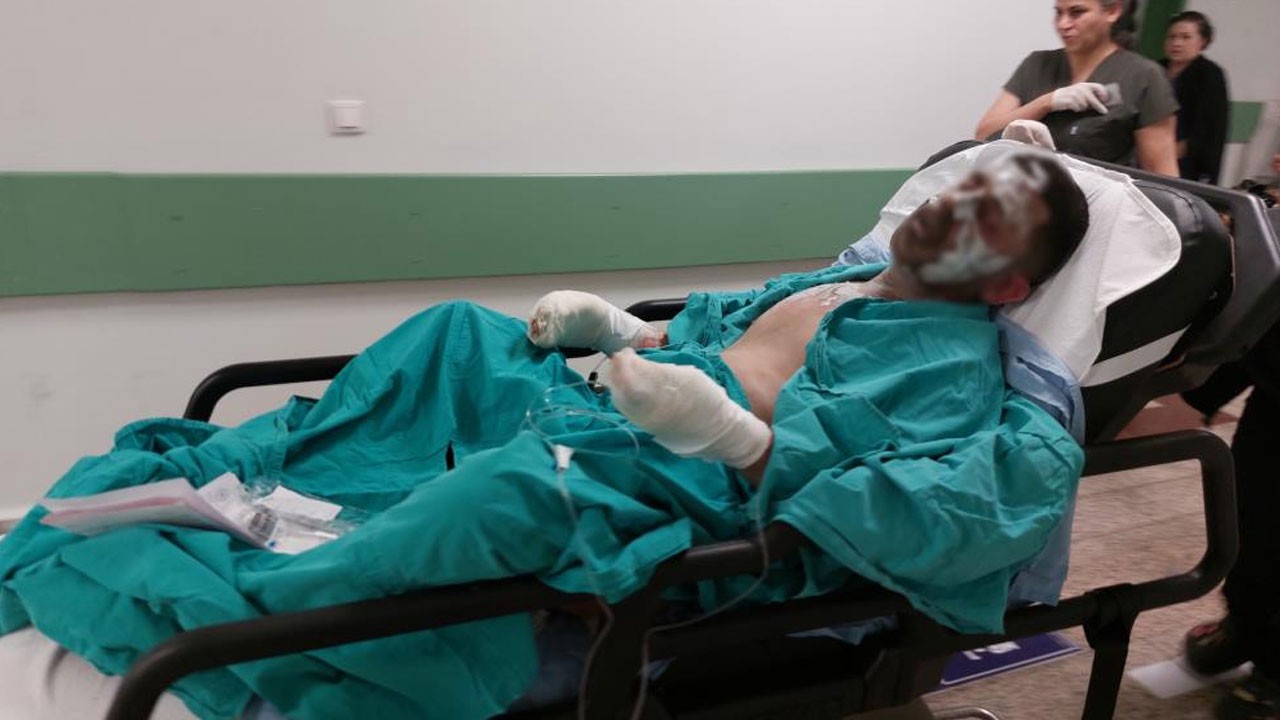 Yaktığı ateşe tiner döktü... Sonrası felaket