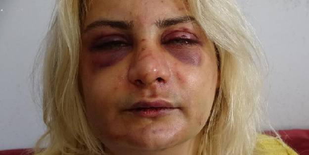 Yalnız yaşayan kadın evinde darp edildi