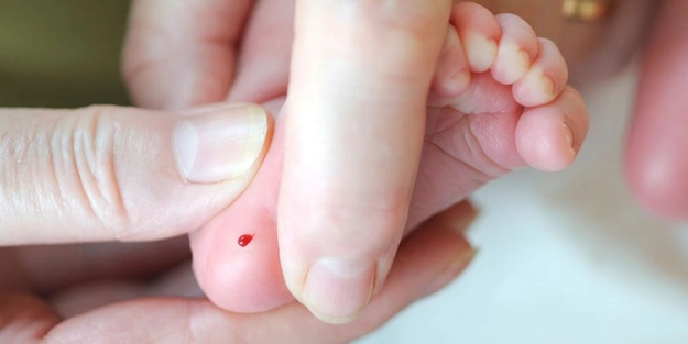 Yalnızca 1 damla topuk kanı hayat kurtarabilir!