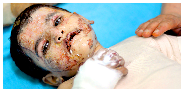 Yamen’in yürek burkan öyküsü