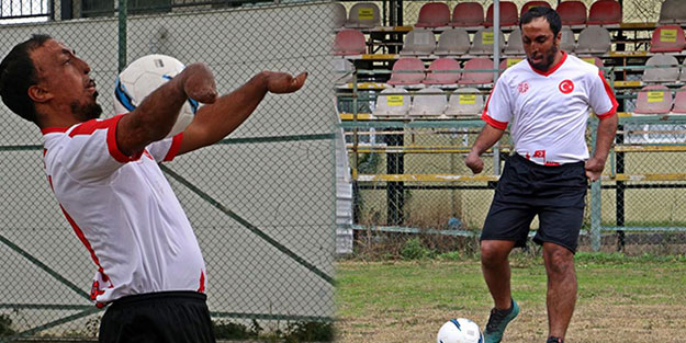 Yangında ellerini ve yüzünü kaybetti ama yılmadı! Gol makinesi oldu