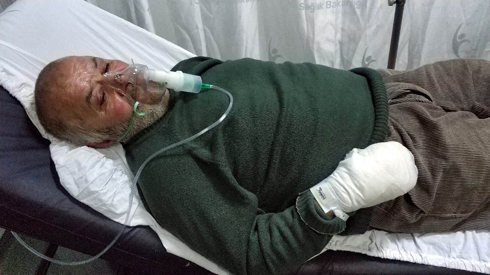 Yangında hayvanları kurtarmak isterken hastanelik oldu 