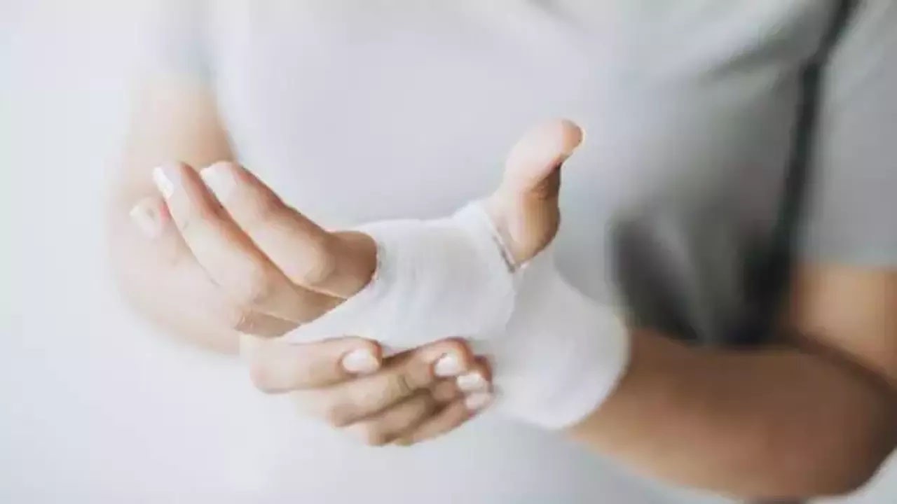 Yanığın üstüne diş macunu, yoğurt sürülür mü? yapmayan bin pişman olacak! Şok olacaksınız