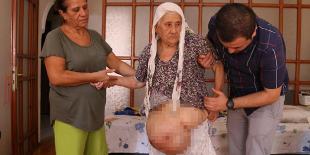 Yanlış ameliyatla hayatı karardı! Tam 46 yıldır...